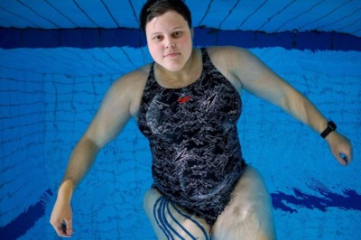 Fikk foten amputert – Nav ville ikke gi henne uføretrygd