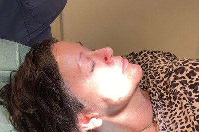 Et problem at tilbud om kreftbehandling bestemmes av postnummer, mener Helsedirektoratet