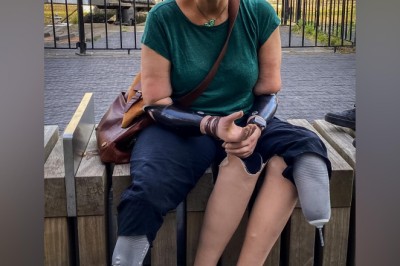 Gry Hege (51) mangler armer og bein – fikk avslag på handikap-parkering